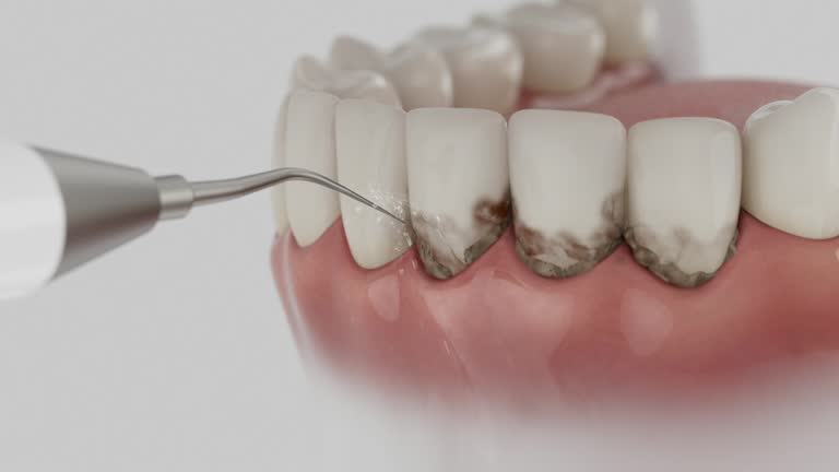 Reliable Dental Implants contractor in East Mountain, TX by Smile Center Dentistry
